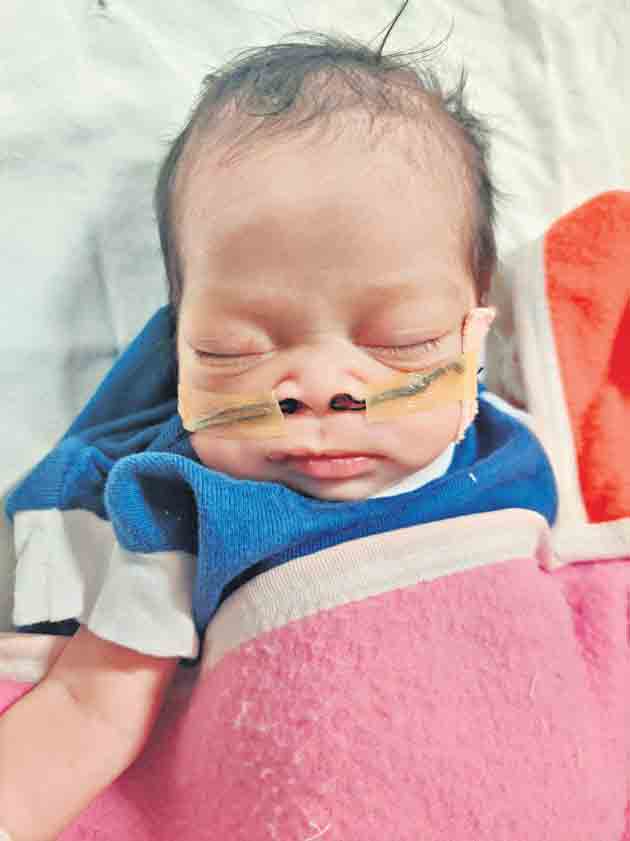 13 రోజుల శిశువుకు ‘ఊపిరి’ పోశారు