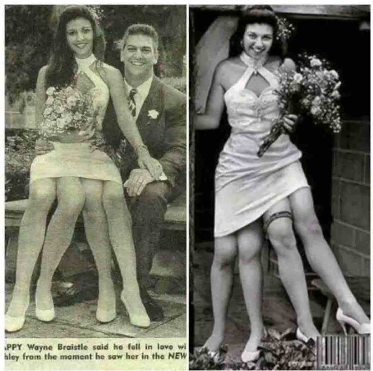 myrtle corbin | నాలుగు కాళ్లు.. రెండు జ‌న‌నేంద్రియాలు.. ఆమె పుట్టుక‌ ఇప్ప‌టికీ మిస్ట‌రీనే