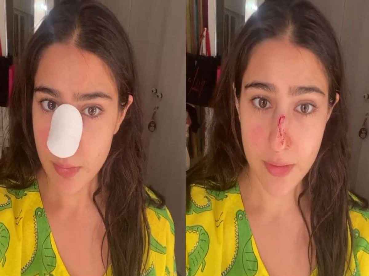 సారా ముక్కుకి బ‌ల‌మైన గాయం.. వీడియో వైర‌ల్‌