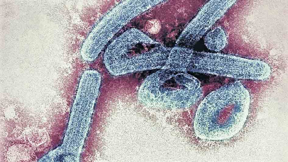 Marburg virus | మందులు లేని మ‌రో ప్రాణాంత‌క‌ వైర‌స్‌.. ఇది సోకితే 88 శాతం మ‌ర‌ణించే ప్ర‌మాదం