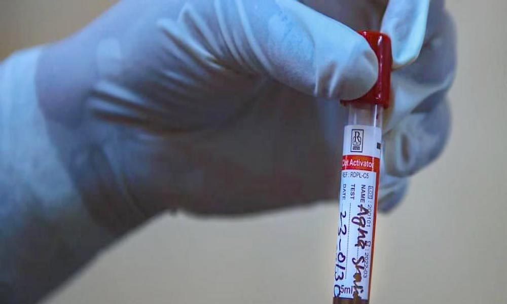 లక్షణాలకు ముందే 50 రకాల క్యాన్సర్లను గుర్తించే ‘గ్యాలరీ’..