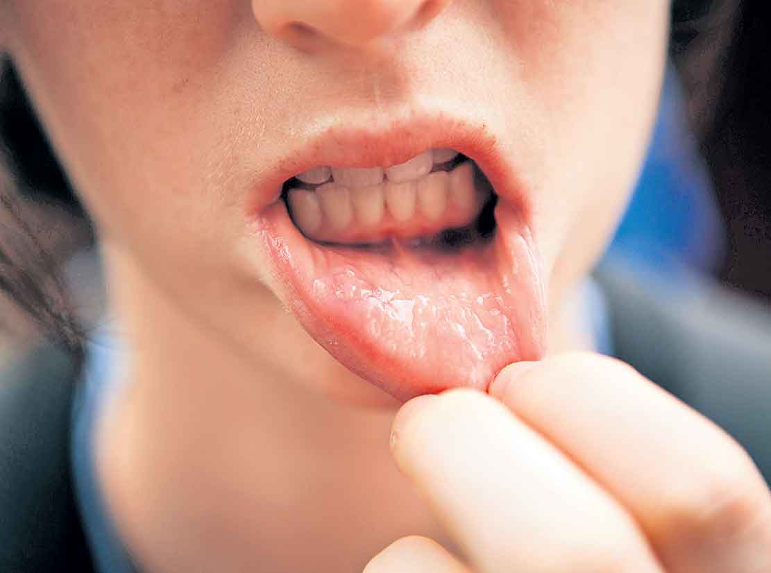 నోటి క్యాన్సర్‌లో మన దేశానిదే మొదటి స్థానం