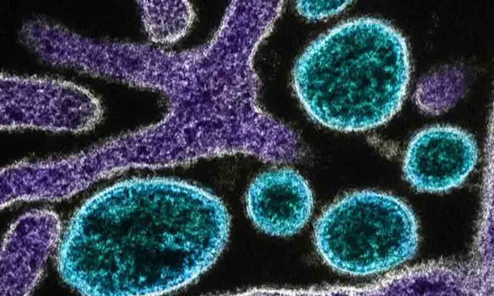 Nipah virus| ఇద్దరు ఆరోగ్య కార్యకర్తలకు నిఫా లక్షణాలు : కేరళ ఆరోగ్యశాఖ మంత్రి