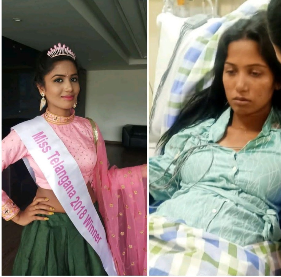 Live suicide | ఆత్మహత్య చేసుకుంటున్నా నంటూ.. ఇన్స్ట్రాగ్రామ్లో లైవ్.. కానీ ఇంతలో..