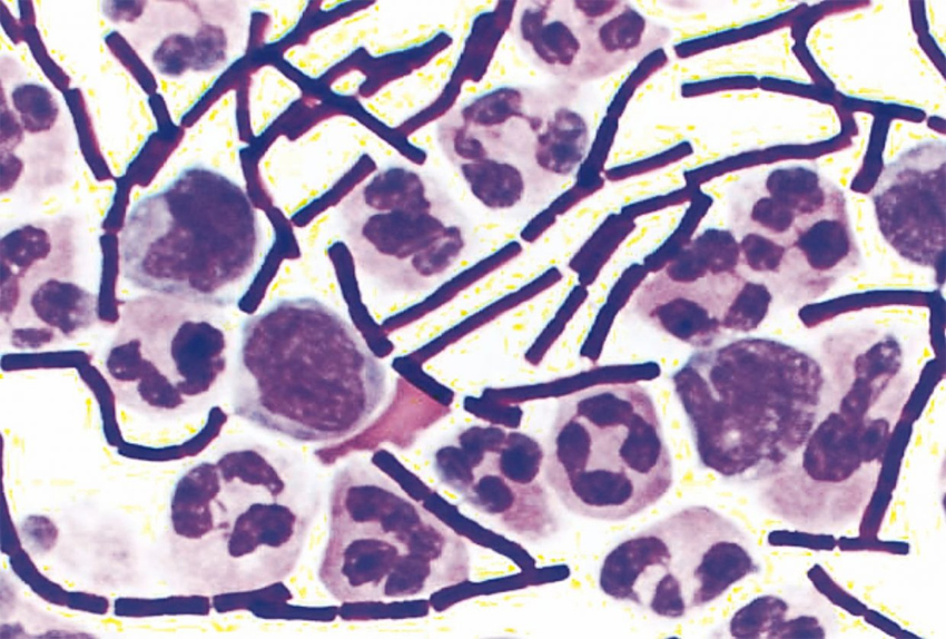 ఆంథ్రాక్స్‌పై ఆందోళన వద్దు