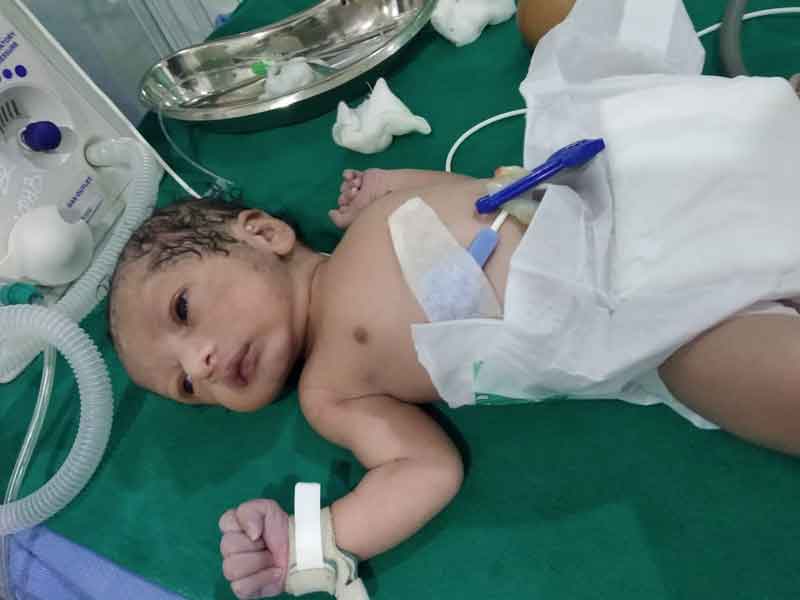 ‘సోనూసూద్‌’ సాయంతో..చిన్నారి ‘గుండె’కు ఆపరేషన్‌