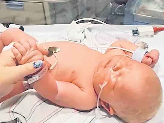 6.3 కిలోల బాలభీముడు