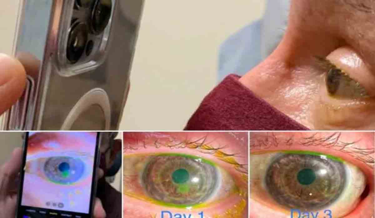 iPhone 13 | ఐఫోన్ 13 కెమెరాతో ట్రీట్‌మెంట్‌.. ఈ డాక్ట‌ర్ షేర్ చేసిన ఫొటో వైర‌ల్‌