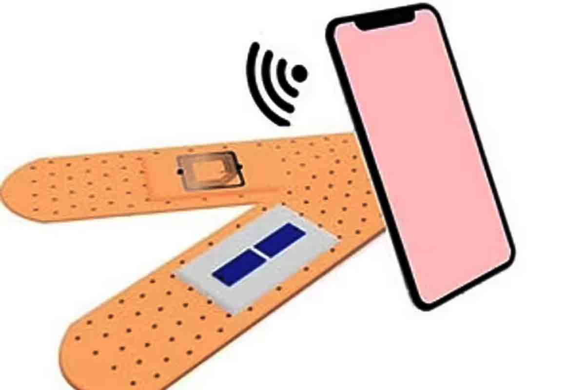 Smart bandage | గాయం న‌య‌మైందో లేదో చెప్పే స‌రికొత్త స్మార్ట్ బ్యాండేజీ.. ఇది ఎలా ప‌నిచేస్తుందంటే..