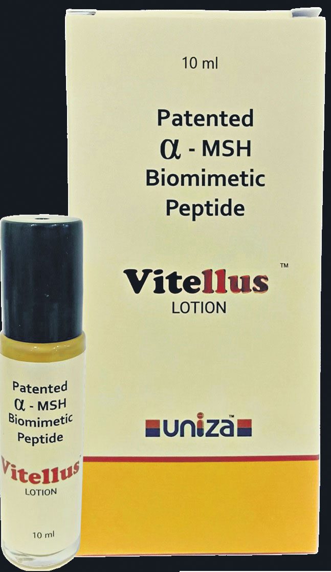 బొల్లి చికిత్సకు ఉనిజా