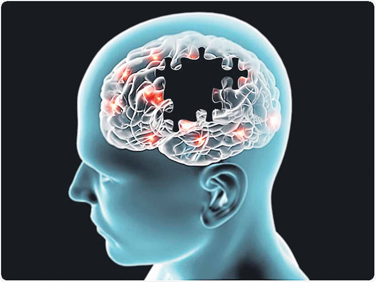 అల్జీమర్స్‌కు టీకా