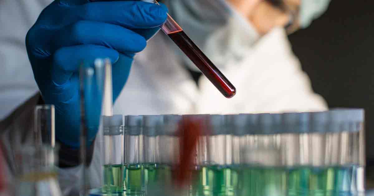 ఒక్క టెస్టుతో 50 క్యాన్సర్ల గుర్తింపు