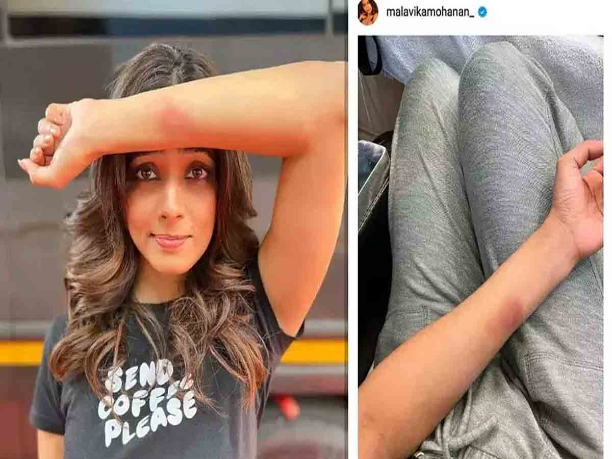 Malavika mohanan: షూటింగ్‌లో గాయ‌ప‌డ్డ ఫొటోల‌ను షేర్ చేసిన హీరోయిన్..!