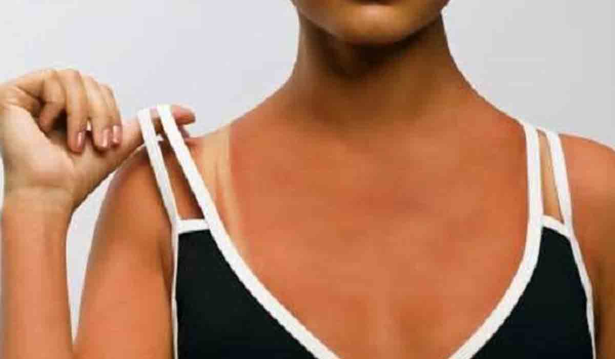 బ్రా స్ట్రాప్స్‌తో బాధ‌ప‌డుతున్నారా.. అయితే ఈ చిట్కాలు మీ కోస‌మే..