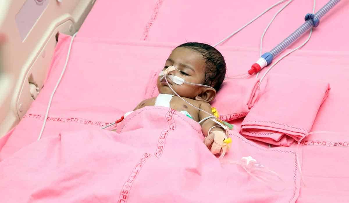 Free Surgery | టీటీడీ ఆసుపత్రిలో విజయవంతంగా మరో ఏడు ఉచిత ఓపెన్ హార్ట్ సర్జరీలు