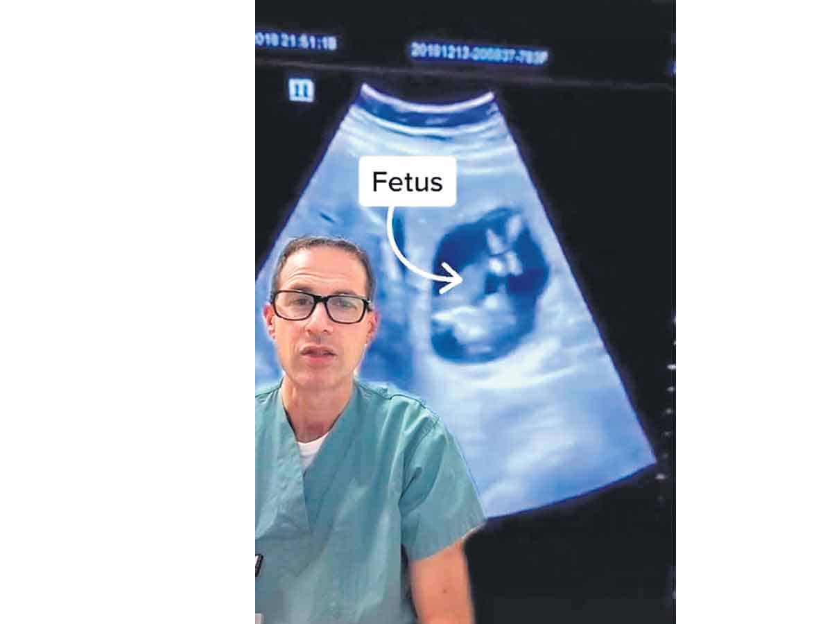 కాలేయంలో పిండం!