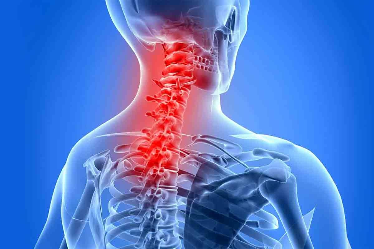 Spondylitis diet | రోజూ ఇవి తింటే స్పాండిలైటిస్ స‌మ‌స్య రానే రాదు