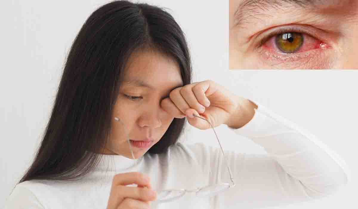 క‌ళ్లు పొడిబారుతున్నాయా..? త‌స్మాత్ జాగ్ర‌త్త‌!