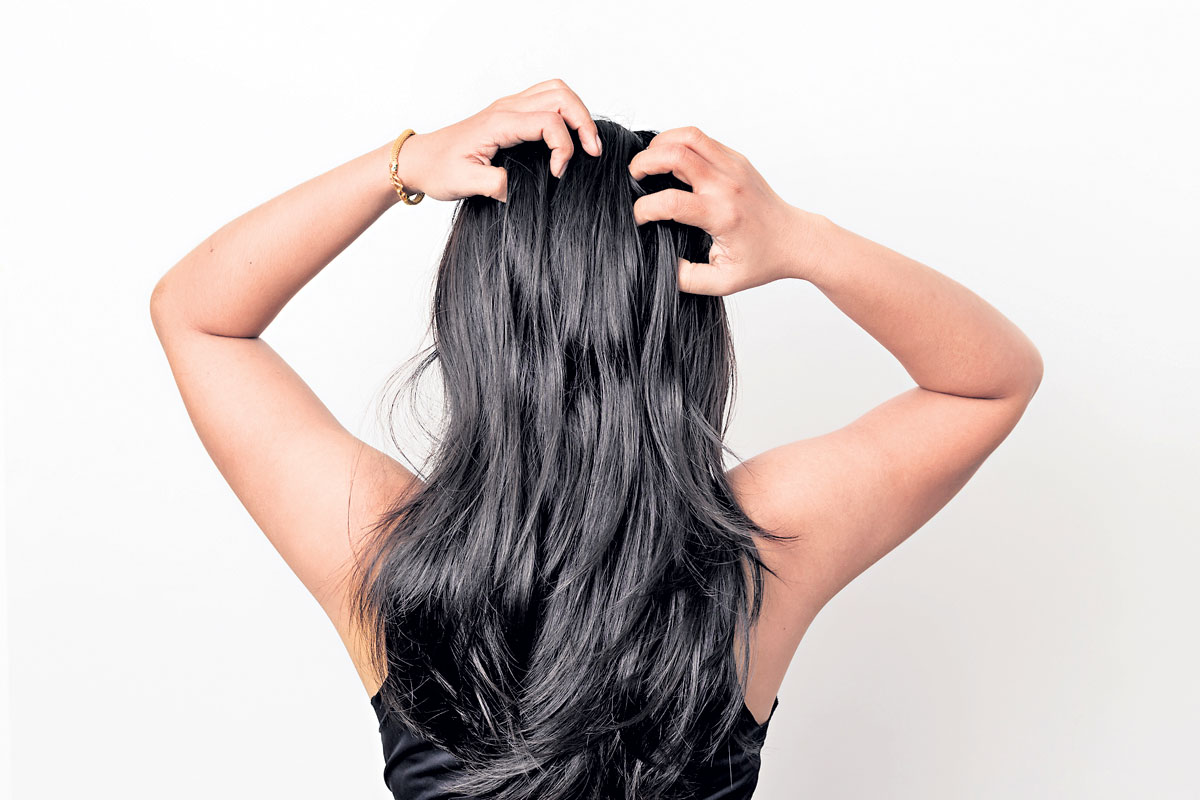 Hair fall | జుట్టు రాల‌డం త‌గ్గాలా? ఉల్లిగ‌డ్డ‌ల‌తో ఇలా చేస్తే స‌రి..