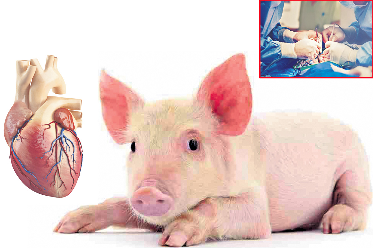 వరాహ పురాణం! పంది గుండె మనిషికి