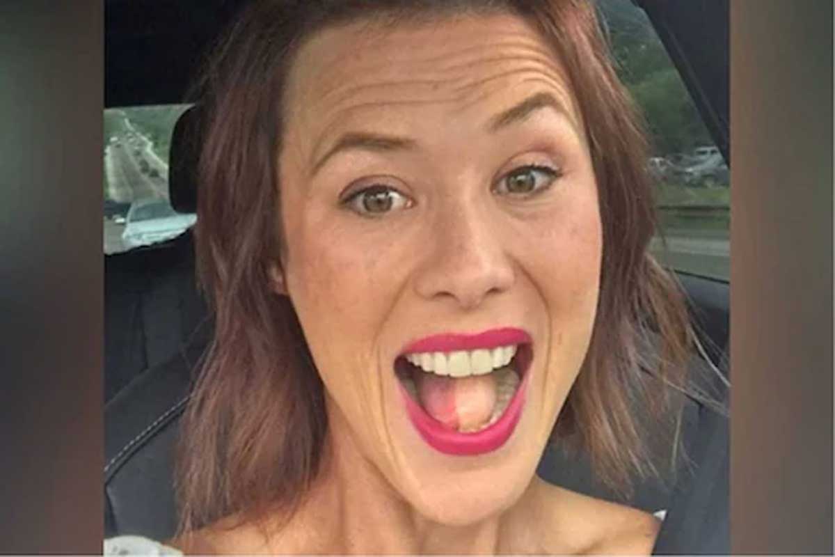 ఆ మ‌హిళ నాలుక మీద వెంట్రుక‌లు మొలిచాయి.. ఎందుకో తెలుసా?