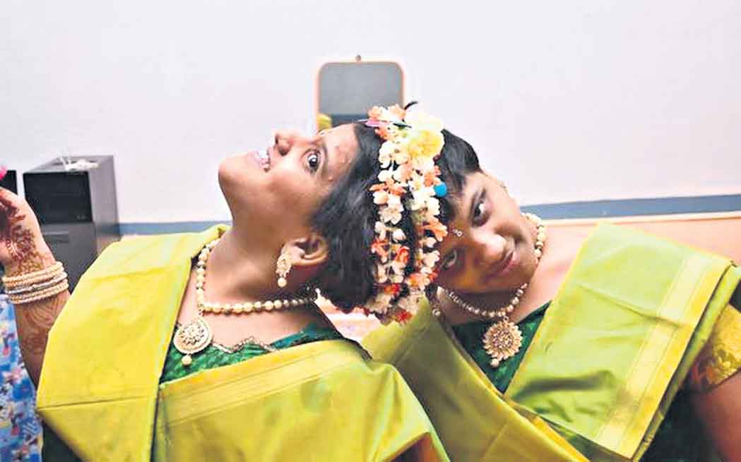 వీణ-వాణిలను వేరు చేస్తే ముప్పే