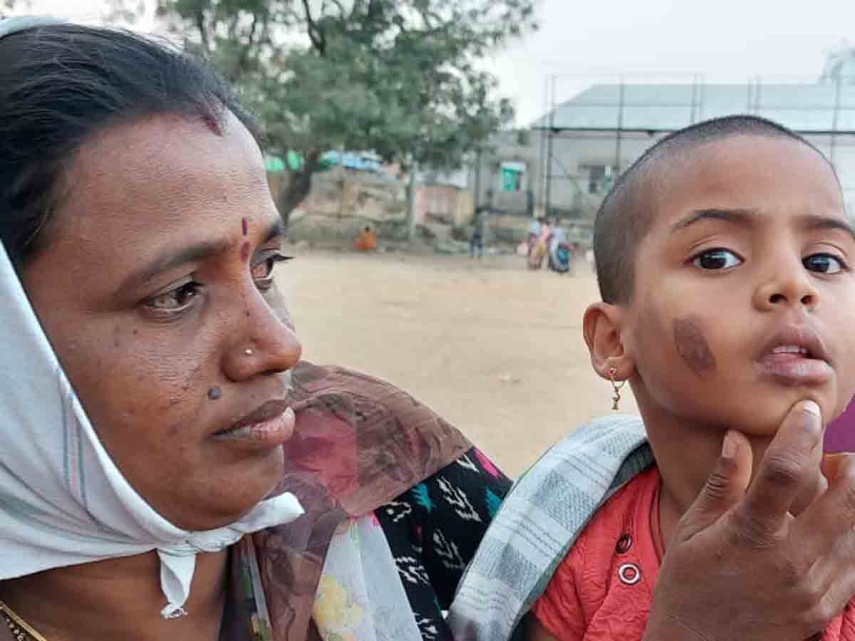 Yadadri : చిన్నారికి అంగన్‌ వాడీ టీచర్‌ వాతలు..