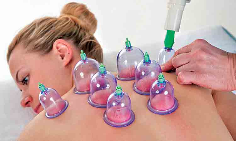 Cupping Therapy | దిశా ప‌టానీ, జాక్వెలిన్‌.. ఇలా బాలీవుడ్ సెలబ్రెటీలు చేయించుకుంటున్న ఈ ట్రీట్‌మెంట్ స్పెషాలిటీ ఏంటి?