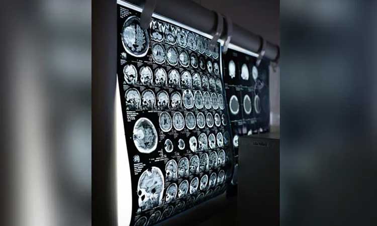 మ‌నిషి చ‌నిపోవ‌డానికి 30 సెకండ్ల ముందు ఏమౌతుందో తెలుసా? వెలుగులోకి సంచ‌ల‌న నిజాలు