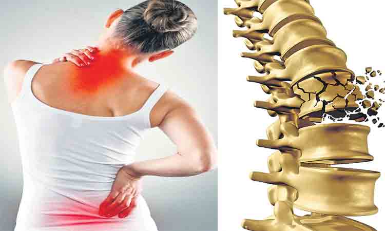 ఎముకల శత్రువు.. ఆస్టియోపొరోసిస్‌