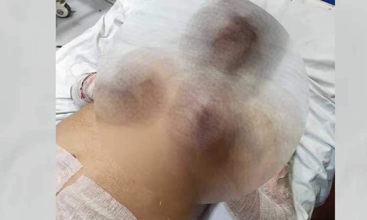 ఎన్నికల్లో ఓటమి.. అభ్యర్థి ఆత్మహుతికి యత్నం..!