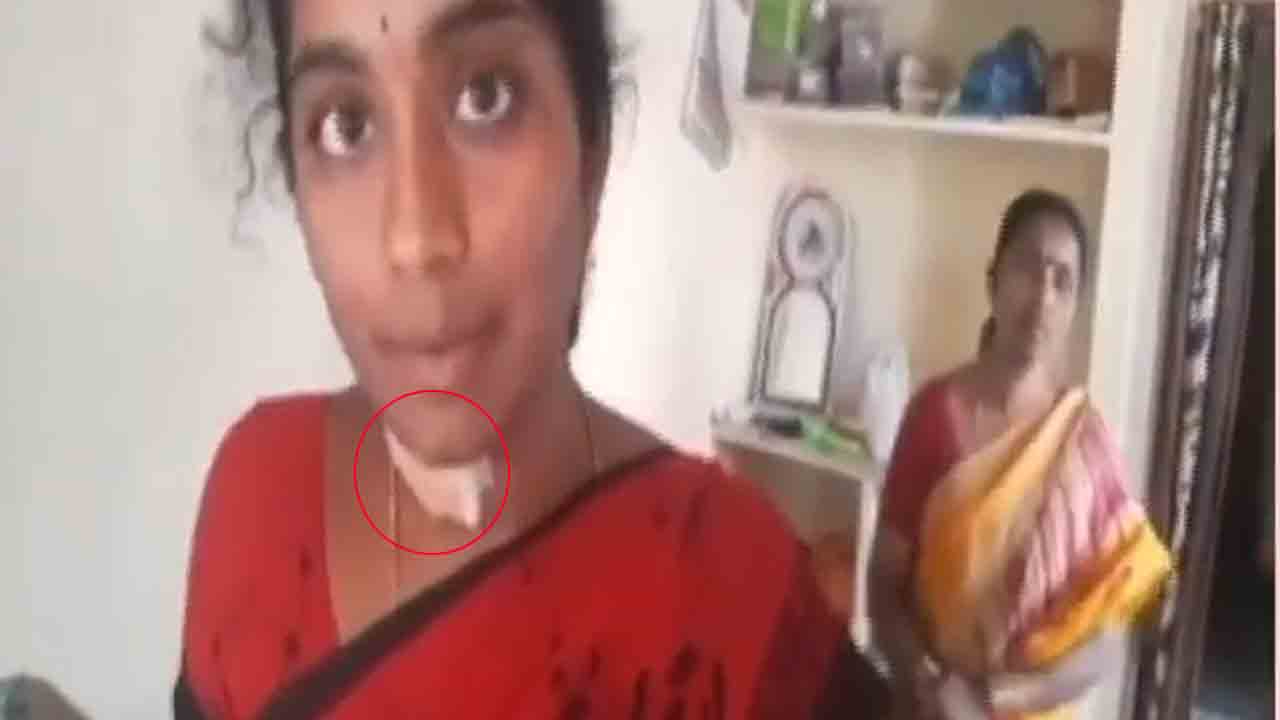 హైదరాబాద్లో దోపిడీ దొంగల బీభత్సం.. మహిళ గొంతు కోసేశారు..