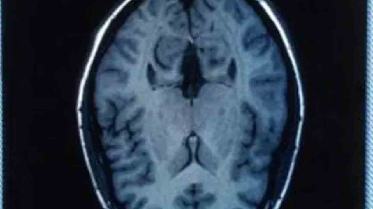 మ‌న‌సు మాట వినాలా? లేక బ్రెయిన్ మాట వినాలా? దేని మాట వింటే ఏమౌతుందో తెలుసా?