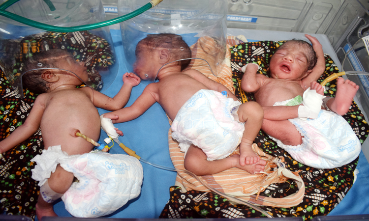 ఒకే కాన్పులో ముగ్గురు శిశువుల జననం