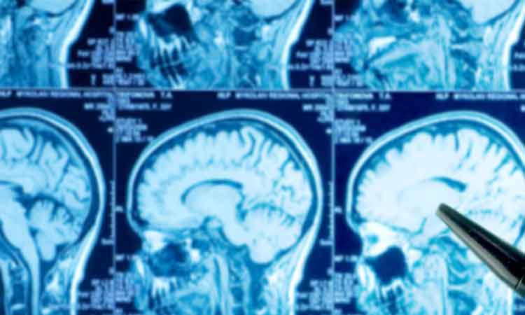 బ్రెయిన్‌ ట్యూమర్‌కు సురక్షిత శస్త్రచికిత్స