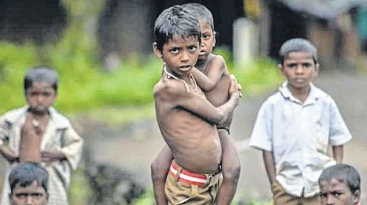 Malnutrition in children | పిల్లల్లో పోషకాహార లోపం-రుగ్మతలు