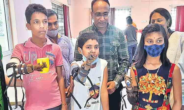 చేతులు లేని వారికి కృత్రిమ ప్రొస్తెటిక్‌ హాండ్స్‌ పంపిణీ