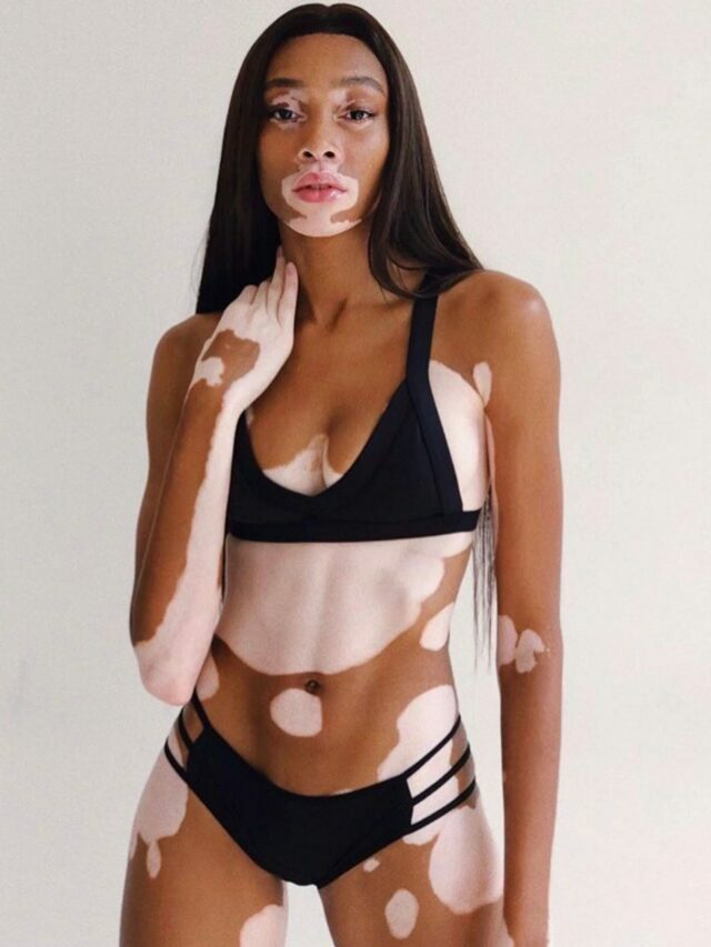 మోడ‌ల్ అంటే అందంగానే ఉండాలా?