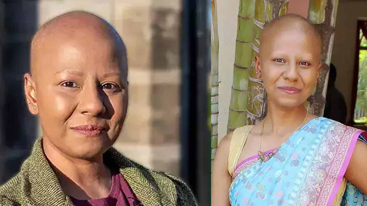 Indina bald woman | గుండు అయితేనేం.. గుండెనిండా విశ్వాసం!