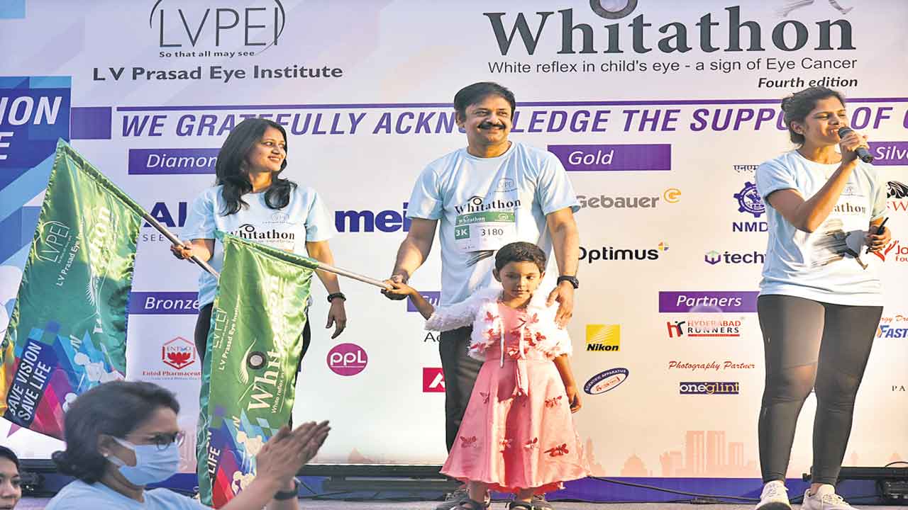 చిన్న పిల్లల్లో కంటి క్యాన్సర్‌..అప్రమత్తం అవుదాం