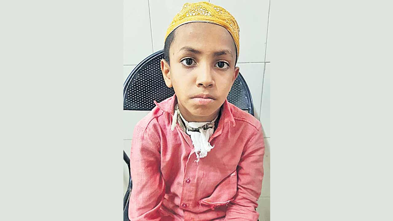 కోఠి ఈఎన్‌టీలో అరుదైన శస్త్ర చికిత్స