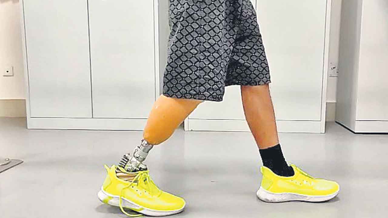 భారత పరిస్థితులకు తగ్గ కృత్రిమ కాలు