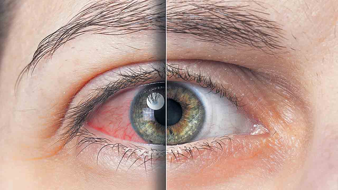 కంటికి రెప్పలా..