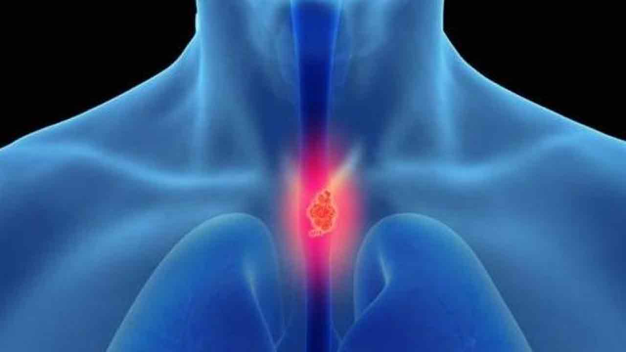 మ‌ధ్య వ‌య‌స్సువారికి అన్న‌వాహిక క్యాన్స‌ర్‌ ముప్పు..తాజా అధ్య‌య‌నంలో వెల్ల‌డి!!