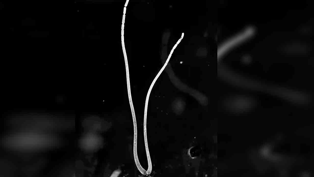 ప్రపంచంలోనే అతిపెద్ద బాక్టీరియా!