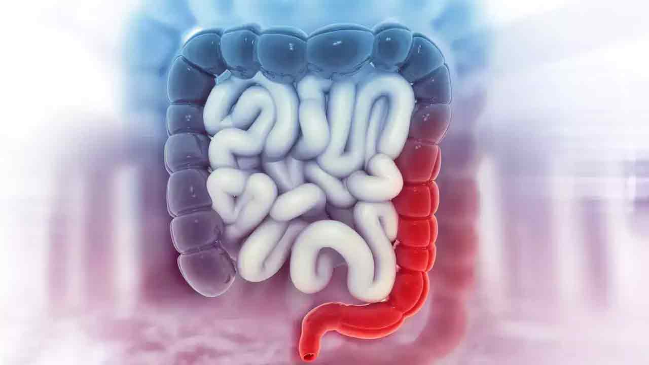 పెద్ద‌పేగు క్యాన్స‌ర్ వ‌చ్చే ప్ర‌మాదం ఎవ‌రికి ఎక్కువ‌గా ఉంటుందంటే?