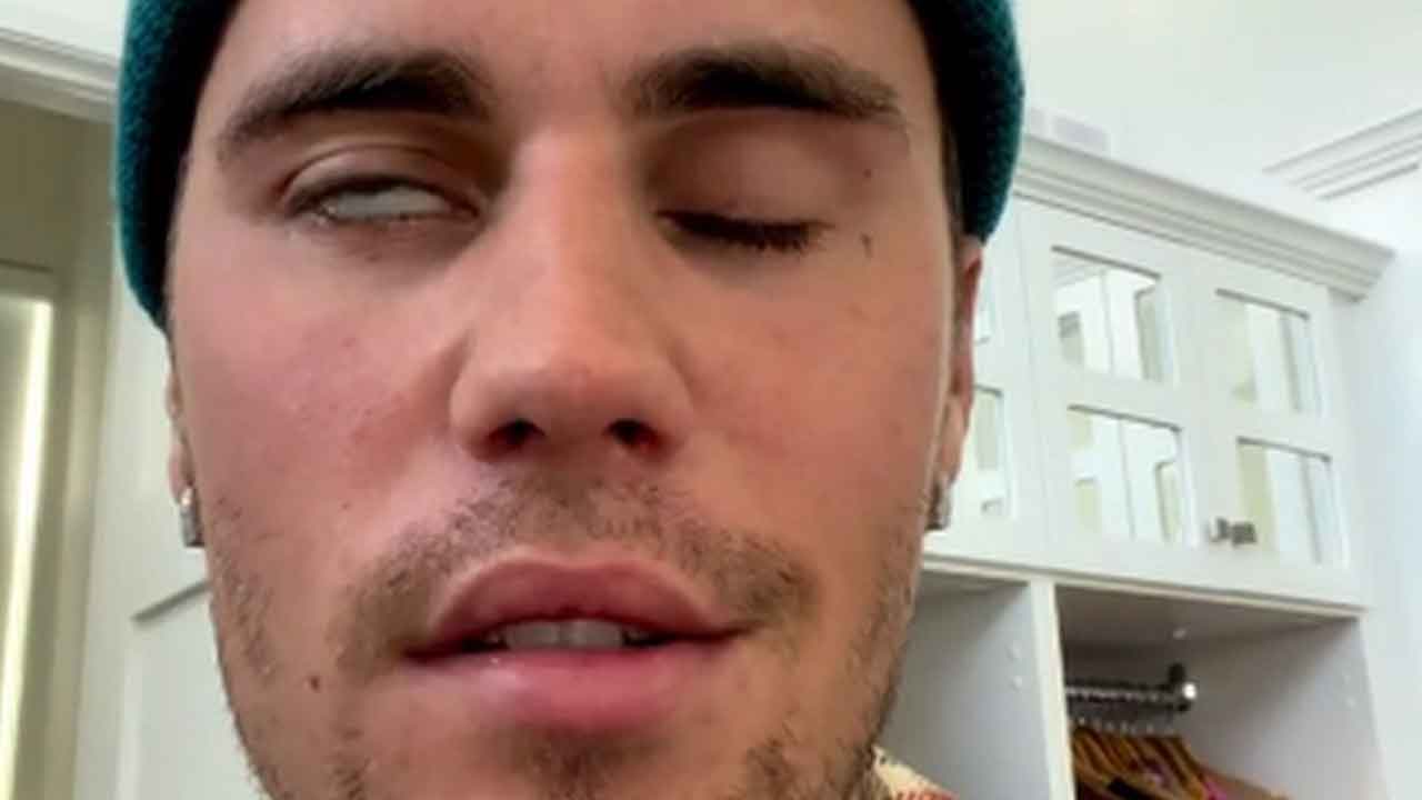 జ‌స్టిన్ బీబ‌ర్‌కు ముఖ ప‌క్ష‌వాతం..