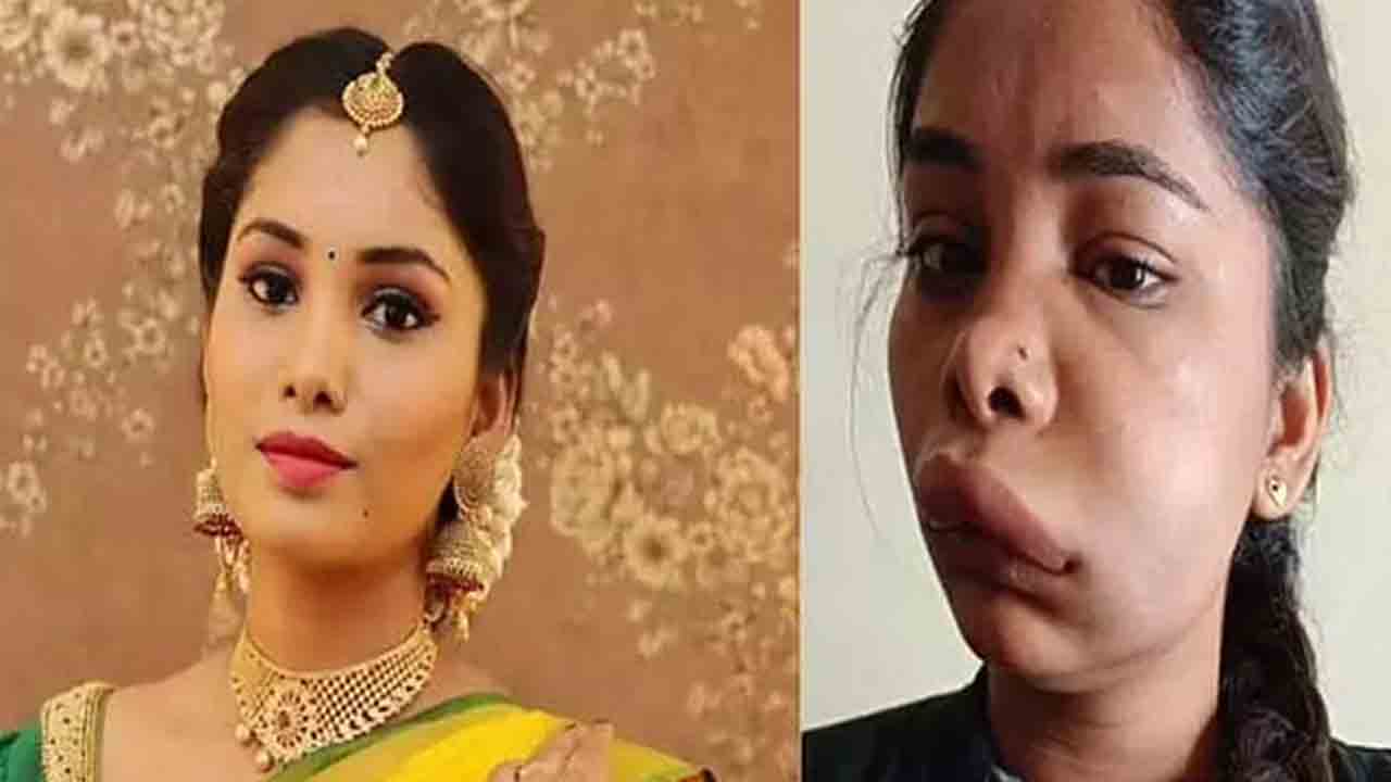 Swathi sathish | స‌ర్జ‌రీ ఫేయిల్ అవ‌డంతో గుర్తుప‌ట్ట‌ని స్థితిలో ప్రముఖ న‌టి!