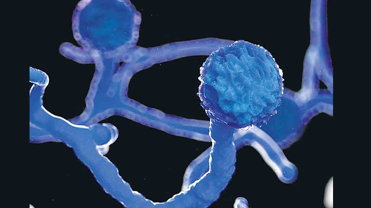 కరోనా తగ్గాక బ్లాక్‌ఫంగస్‌ వస్తుందా?