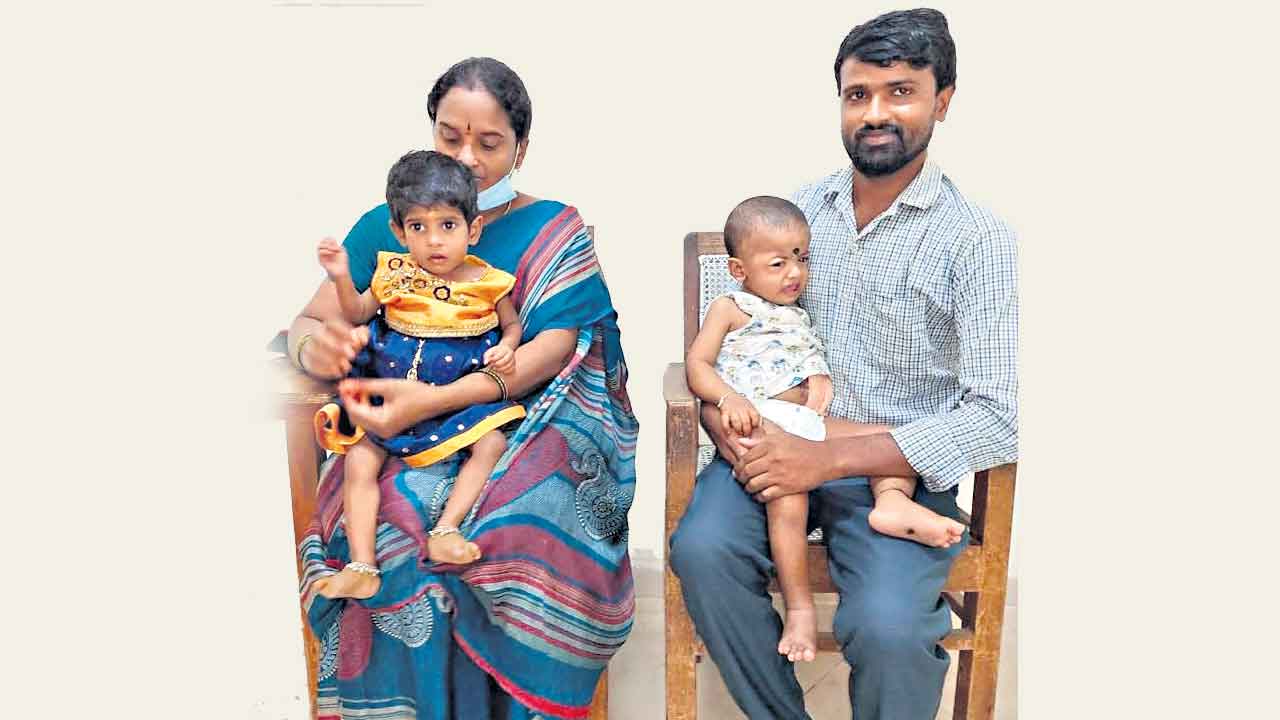 పెద్ద పేగుతో అన్నవాహిక తయారీ.. చిన్నారికి నిమ్స్‌లో అరుదైన శస్త్రచికిత్స